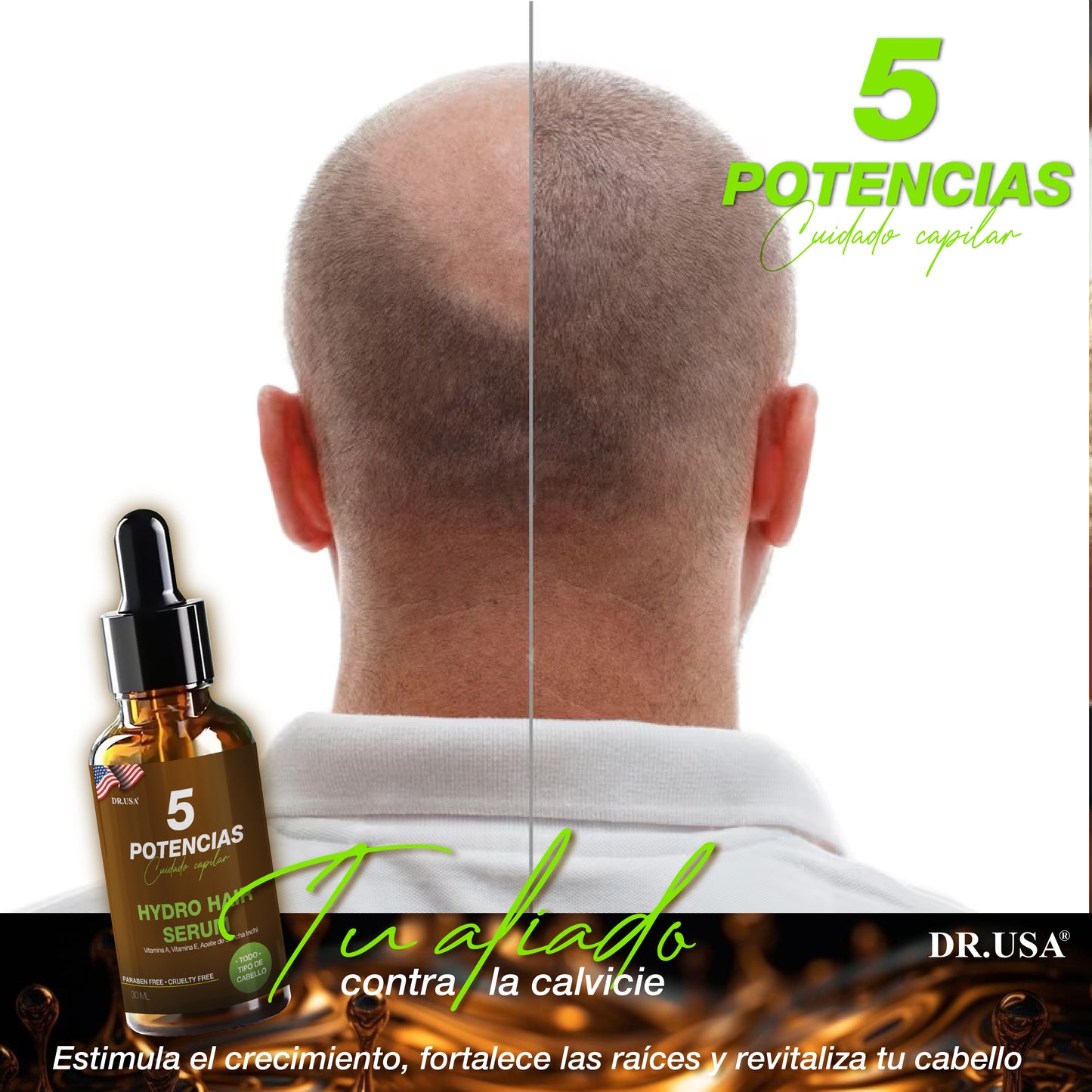 Serum 5 Potencias Anticaída de Cabello